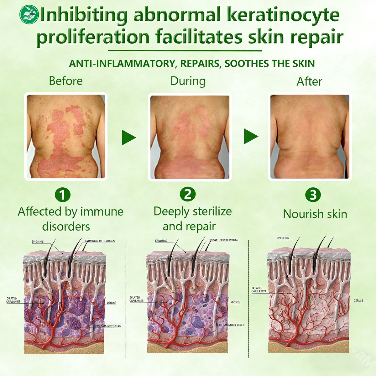 Herbal Miracle Cream for Stubborn Skin Issues